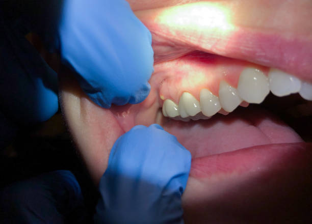  Lincoln Rk, PA Emergency Dentist Pros